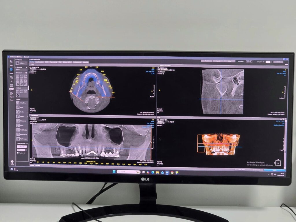 stomatologie ghidata