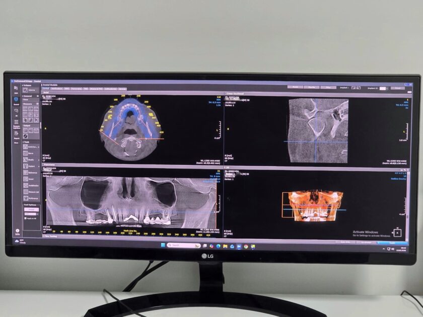 stomatologie ghidata