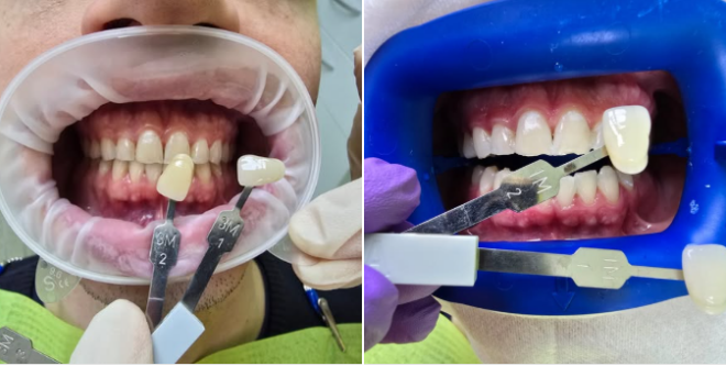 dental alliance