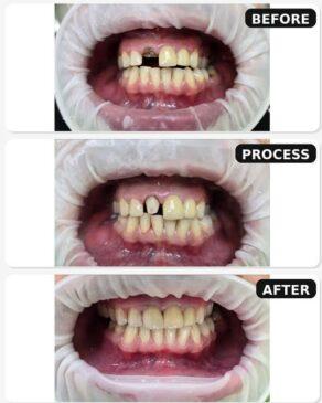 dental alliance