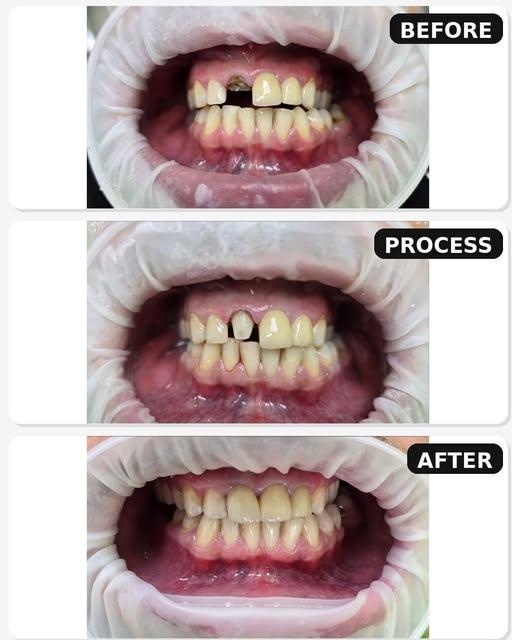 dental alliance