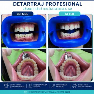 dental alliance