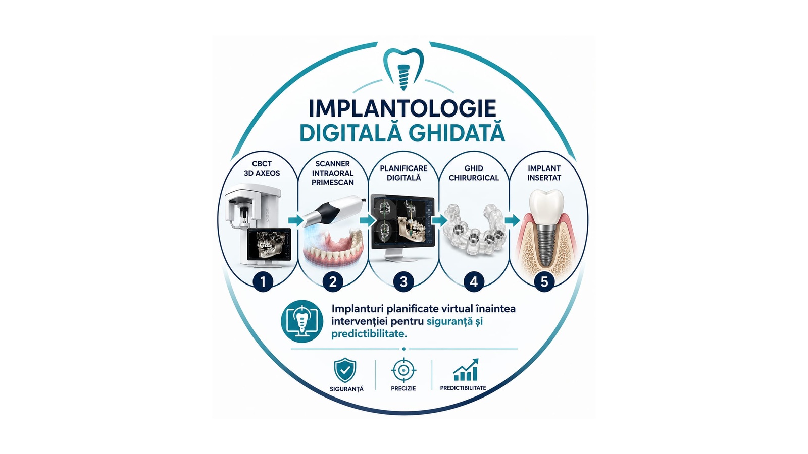 Implantologie digitală ghidată cu CBCT 3D și planificare digitală